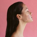 5 Cara Mengatasi Jerawat dengan Menyeimbangkan Hormon Anda