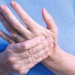 5 Cara Mengatasi Nyeri Sendi di Tangan Secara Efektif