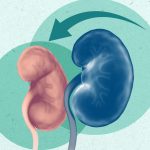 5 Langkah Pemulihan Setelah Mengalami Masalah Ginjal