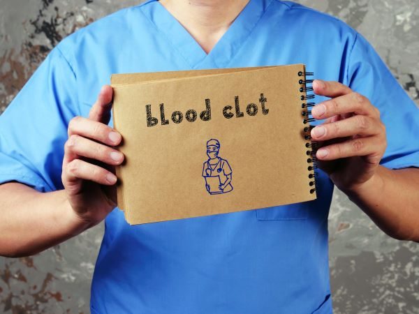 10 Langkah Menghindari Penggumpalan Darah Berbahaya