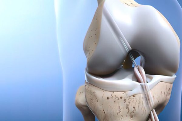 7 Cara Menguatkan Ligamen Lutut Secara Alami 7 Cara Menguatkan Ligamen Lutut Secara Alami