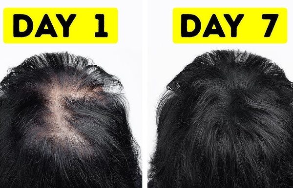 10 Cara Alami Menebalkan Rambut Tipis