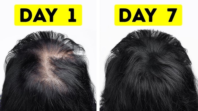 10 Cara Alami Menebalkan Rambut Tipis